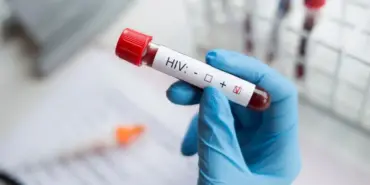 hiv-aids