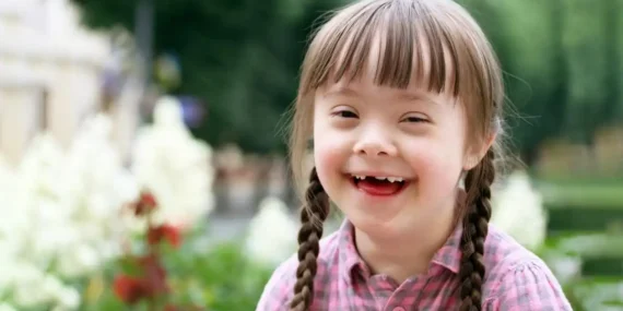 Down Sendromu Nedir ?
