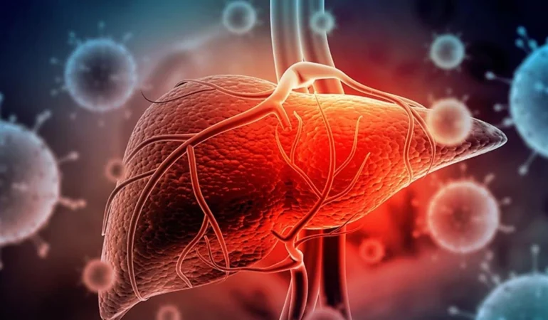 hepatit