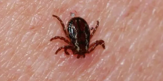 Vücudunuza kene yapışmışsa zarar vermeyin!