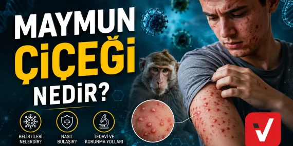 Maymun Çiçeği Nedir? Belirtileri ve Korunma Yolları 2026